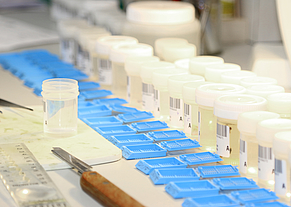 Probenröhrchen und blaue Kästchen auf Labortisch, hautkrebsbehandlung in rostock